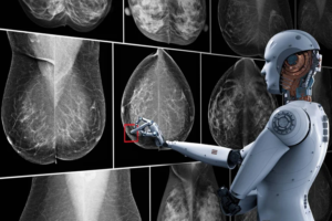 Esta IA es capaz de detectar más rápido el cáncer de mama